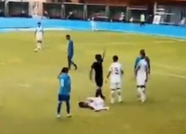 九鼎 这是踢球？全运会惊现暴力犯规致受伤球员腓骨骨折